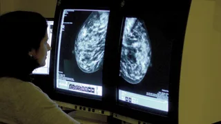 Women under 50 at risk of breast cancer are not being referred - study