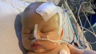 Newborn baby's nail infection led to brain tumour diagnosis