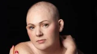 Chemo hair loss doesn't define me - it's a symbol that I'm strong