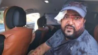 Palestinians and US journalist injured by Israeli settlers in West Bank harvest attack